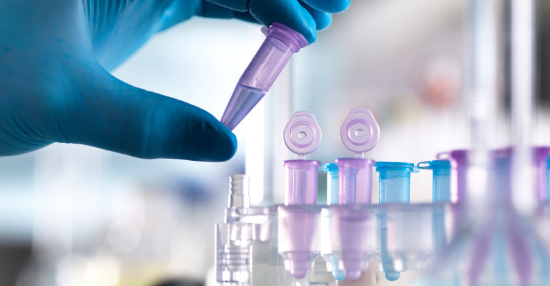 マイクロチューブを持っている写真